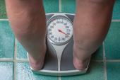 SURMOUNT-1: Tirzepatide Drastically Reduces Weight in Obese Patients